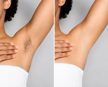 luxe Hair -Removal Cream
