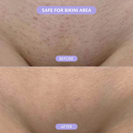 luxe Hair -Removal Cream